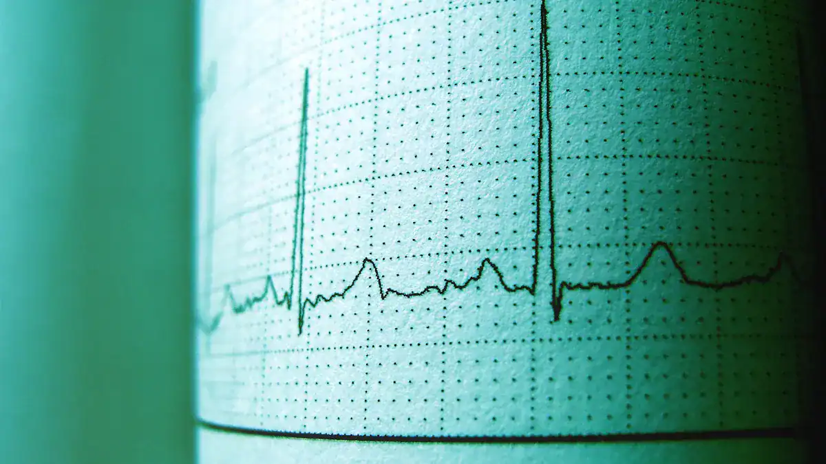 Understanding the QT Interval