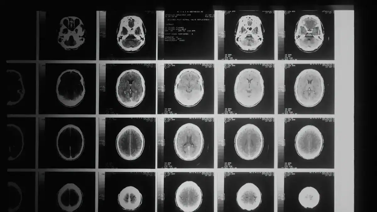 Brain Bleeds: Critical Recovery & Healing Timeline