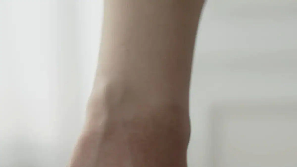 Understanding Cold Legs