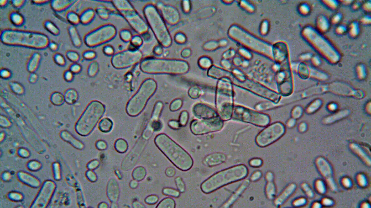 Abnormal Urine Analysis: Urgent Results Explained