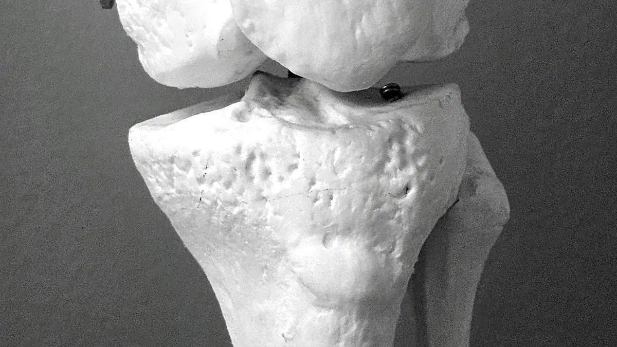 Bones of the Knee Joint