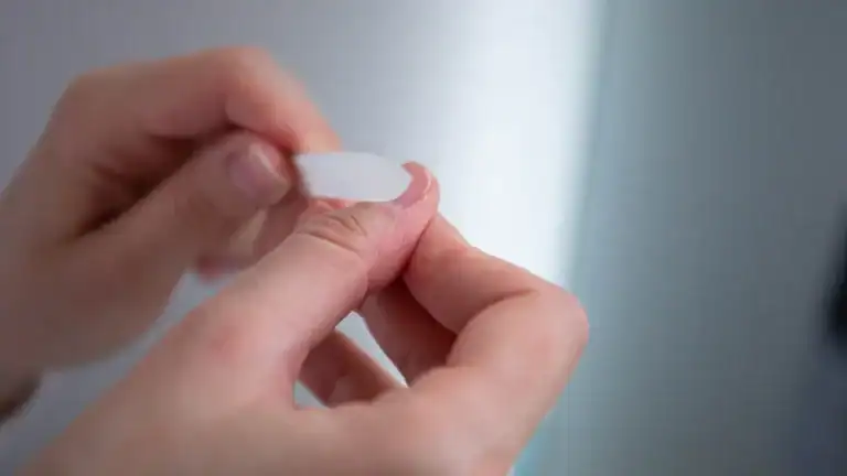 What to do when your Fingernail Fell Off: Causes, Healing, & Prevention