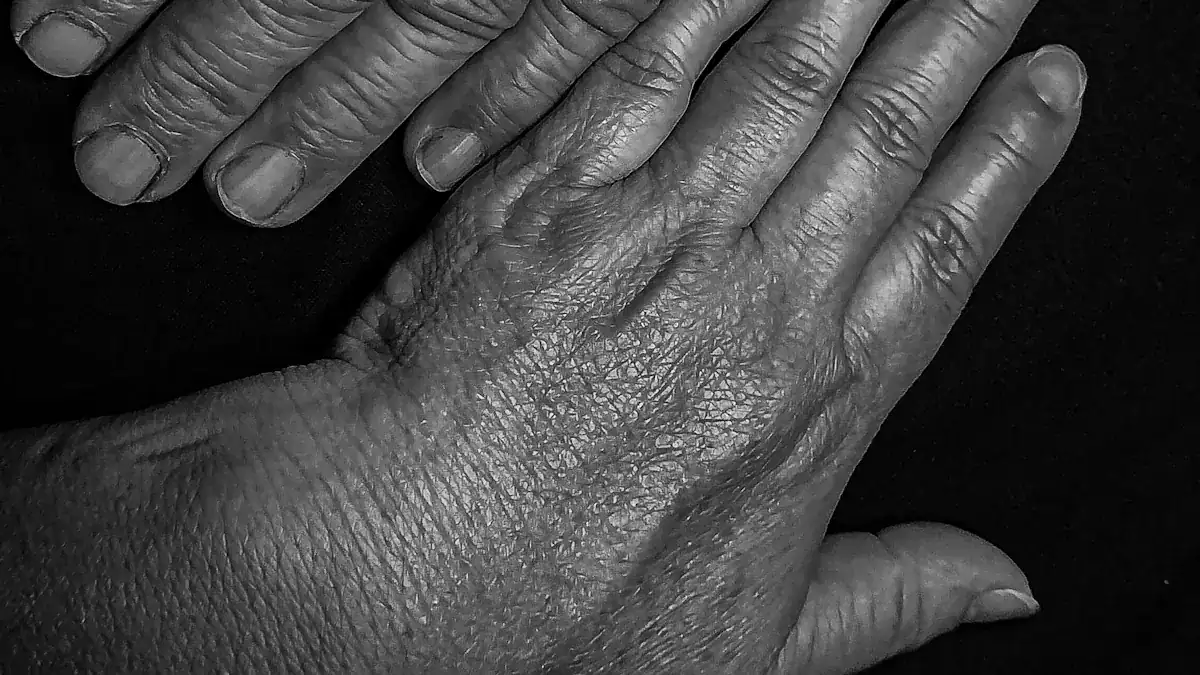 Arthritis and Middle Knuckle Pain