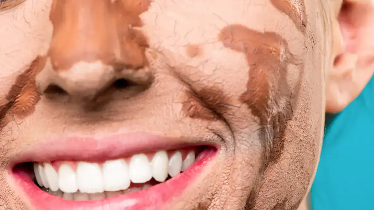 Physical Body Cleanse Symptoms