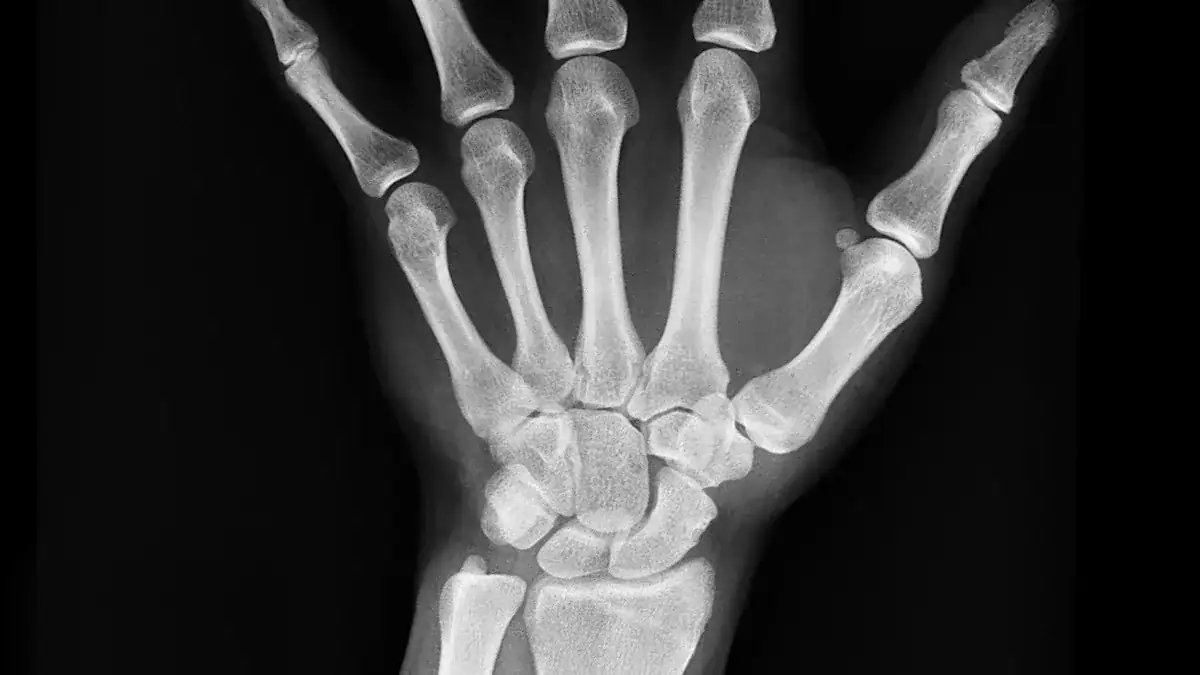 Finger Bones: Skeletal Framework of Finger Anatomy