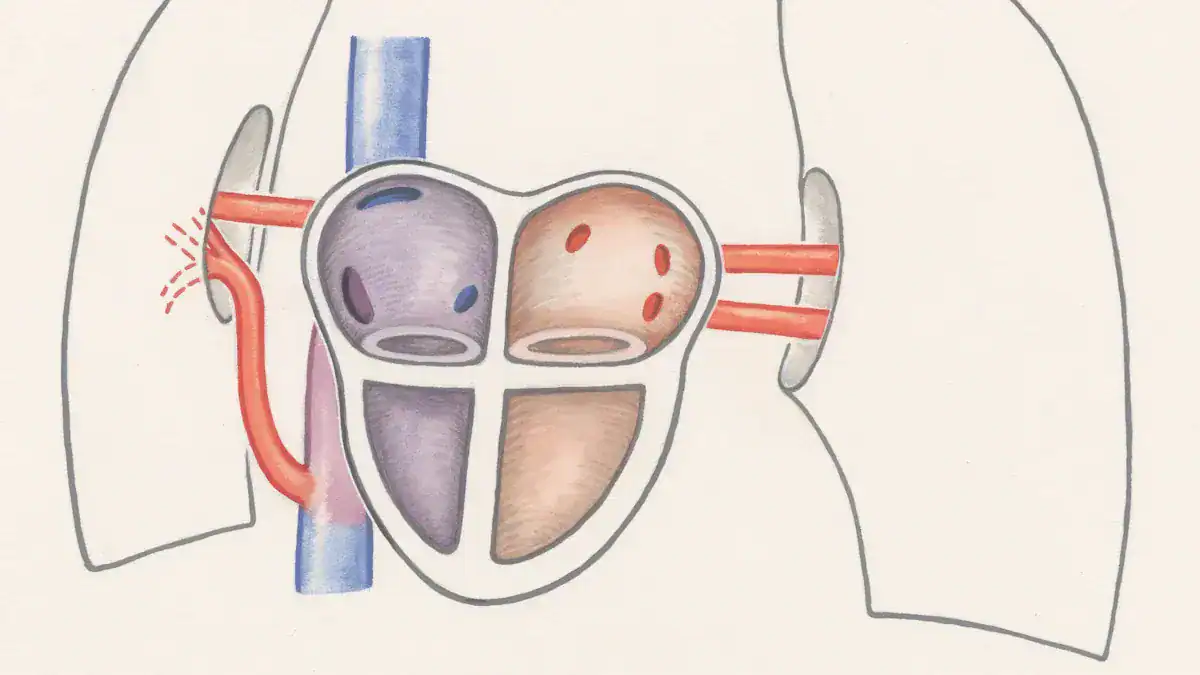 How a Tortuous Aorta Affects Your Heart