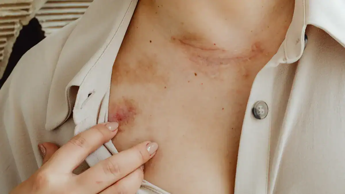 Urgent Causes of Rashes That Come and Go