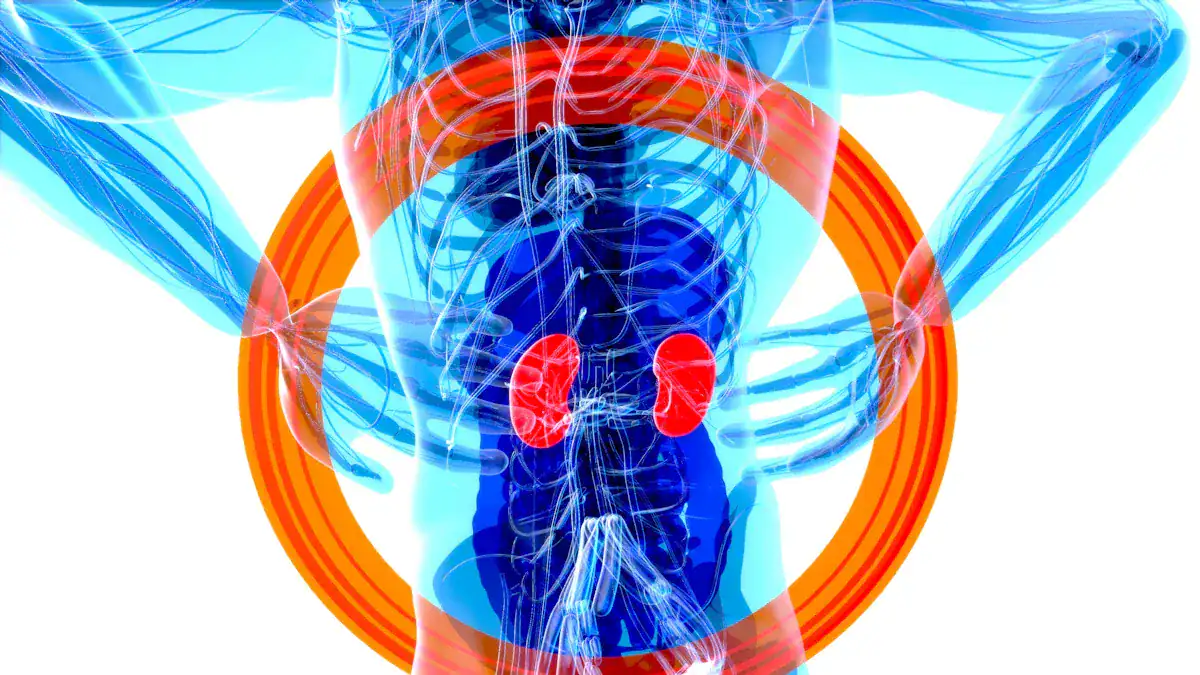 Understanding Kidney Cysts:
