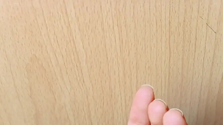 Right Hand Swelling: Causes, Relief