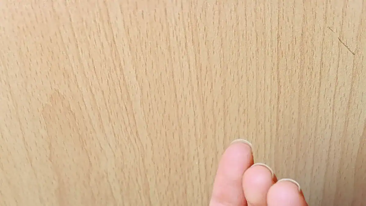 Right Hand Swelling: Causes, Relief