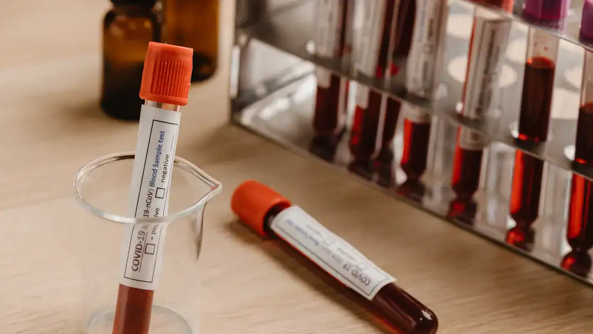 Diagnosing Lymphopenia