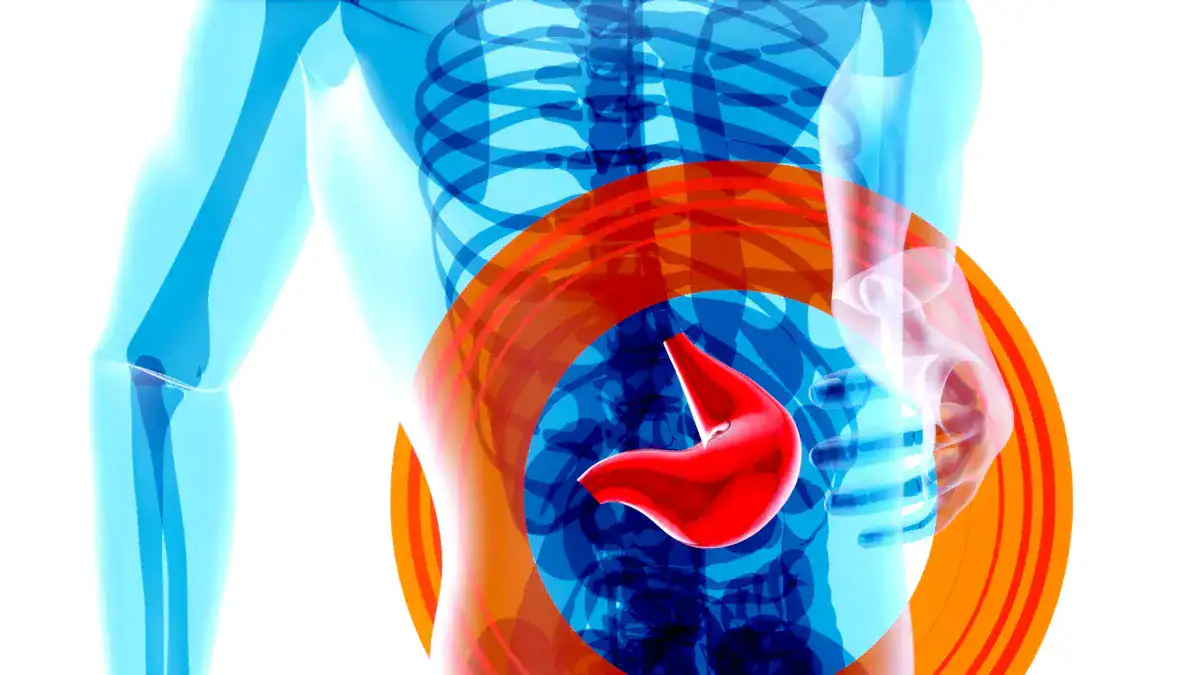 Understanding Pain Around the Belly Button (Periumbilical Pain)