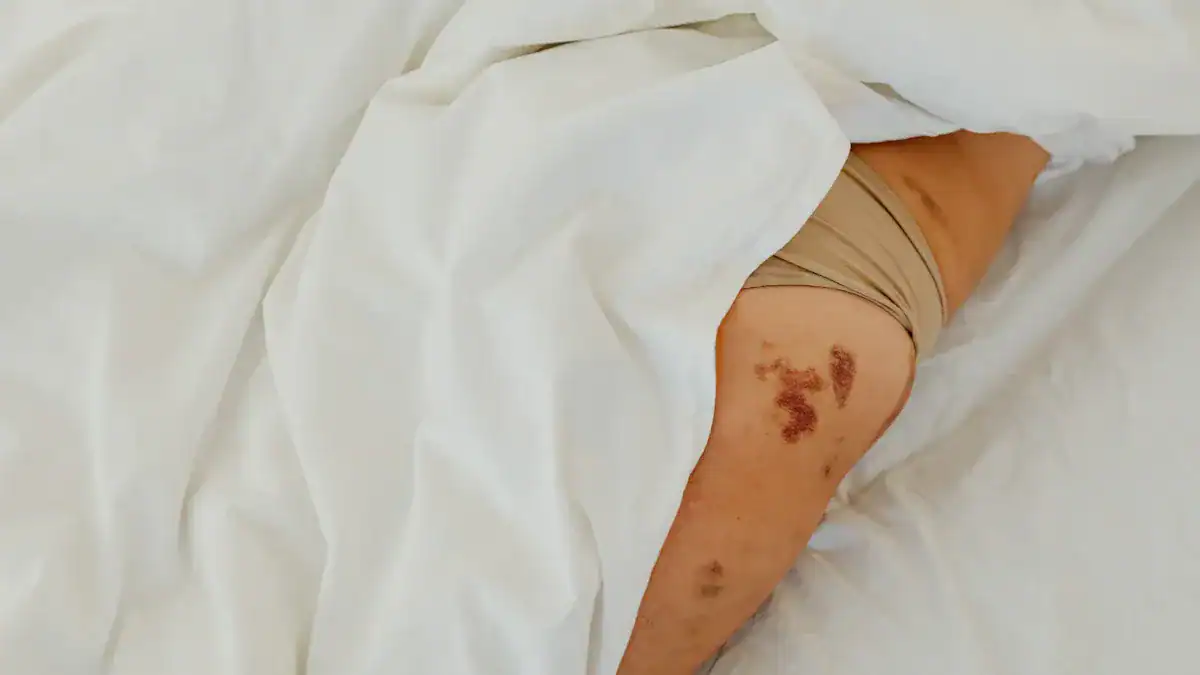 Immediate Knee Surgery Recovery: Days 1-7