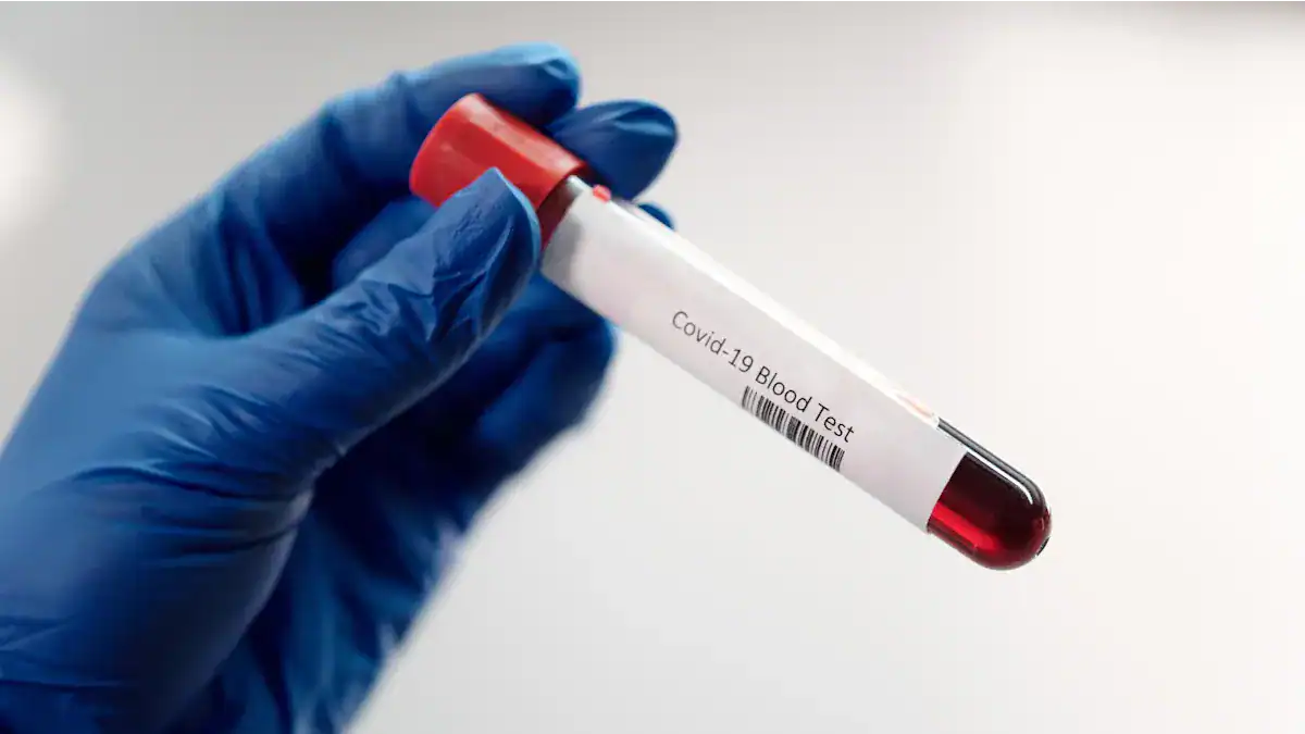 High Immunoglobulin Levels: Urgent Meaning & Causes