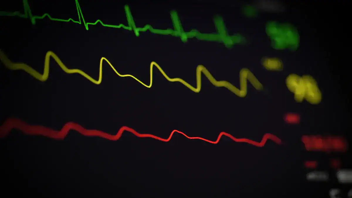 Interpreting Color Doppler Echocardiogram Results