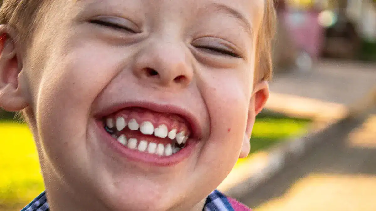 Child Dental Chart Explained