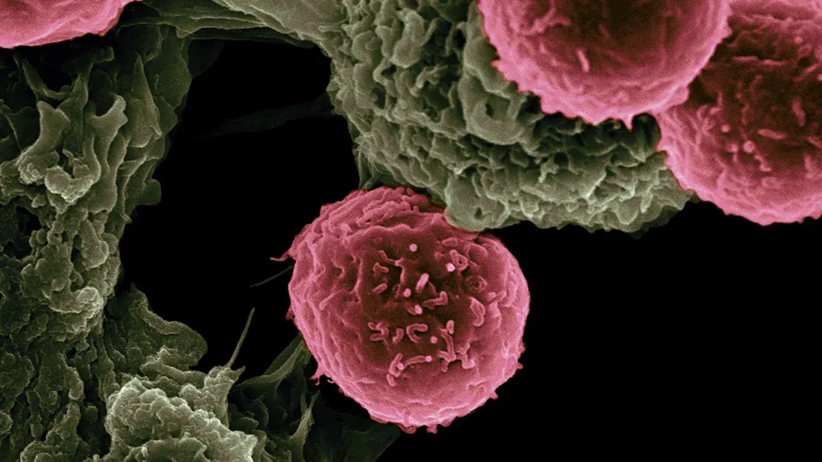 Understanding MPV: What It Is and Why It Matters