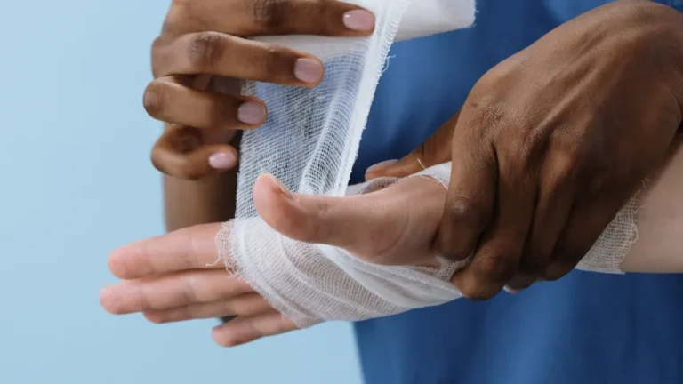 Swollen Hand Due to Trauma: Causes, Symptoms & Immediate Care