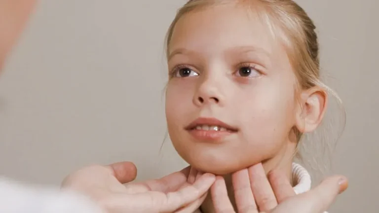 Swollen Lymph Node Under The Jaw