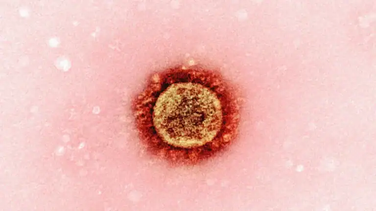 Home remedies for cold sores