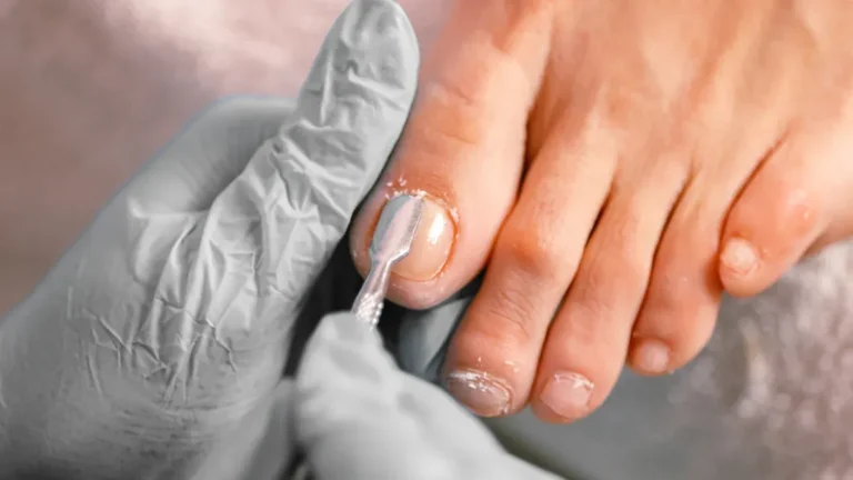 What to Do if You Cut Your Toenail Too Short