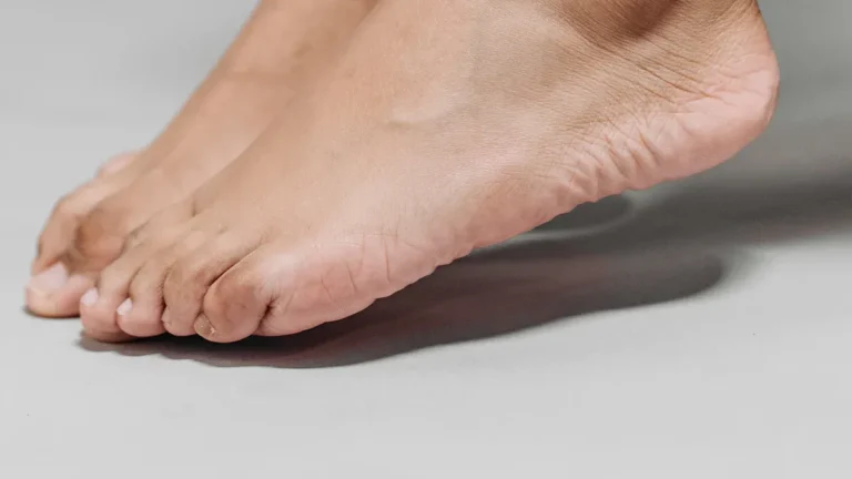 Baking Soda for Nail Fungus: Natural Home Remedy & Cure