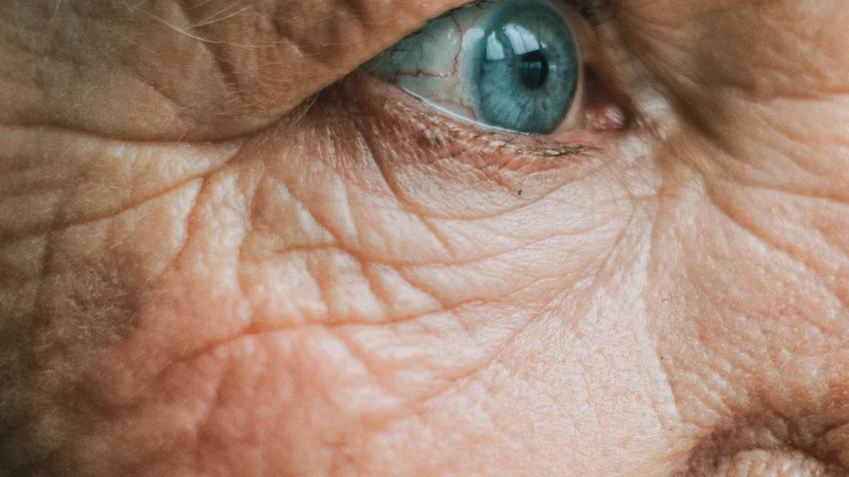Understanding Under-Eye Wrinkles