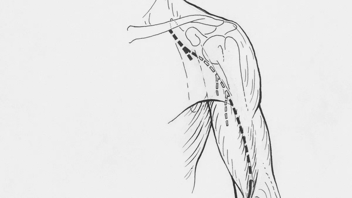 Arm Anatomy: Essential Bone, Muscle, & Nerve Diagram